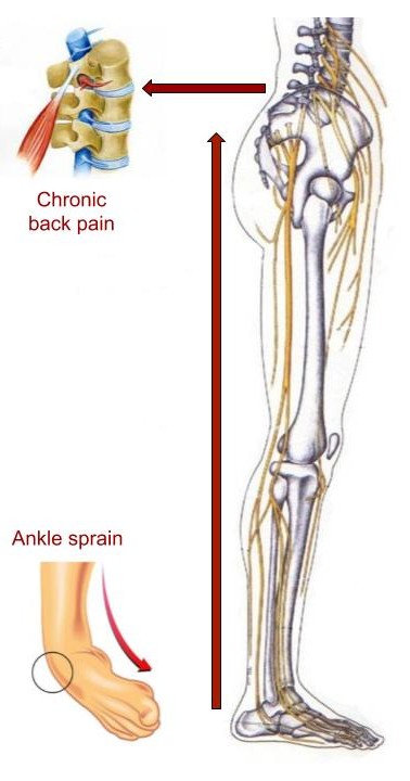 Osteopathy Low back pain, leg pain, foot pain